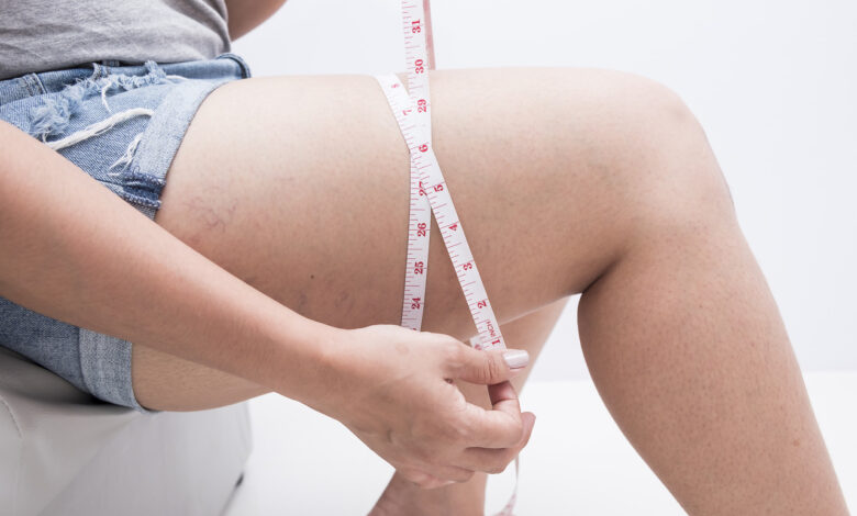 is-it-possible-to-lose-thigh-fat-in-two-weeks?:-healthifyme